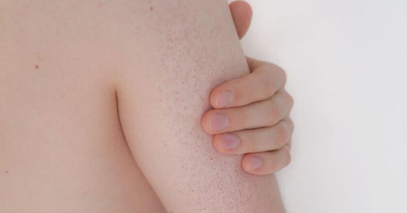 Vücutta kırmızı lekeler mi? Vücuttaki kırmızı lekeler puanları nasıl geçiyor?