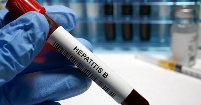 Hepatit B semptomları nelerdir? Hepatit B Nasıl Anlaşılır? Tedavi yöntemleri nelerdir?