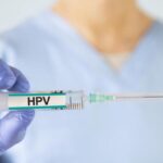 HPV nedir, neden? HPV nasıl iletilir? HPV virüsünün belirtileri nelerdir?